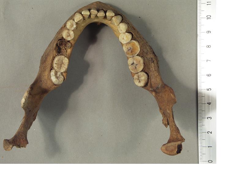 Senaatintorin luututkimusten tuloksia
