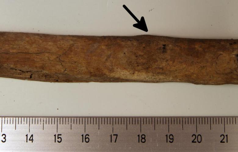 Senaatintorin luututkimusten tuloksia