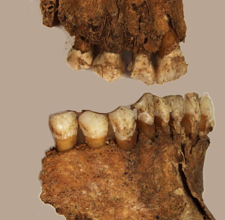 Senaatintorin luututkimusten tuloksia