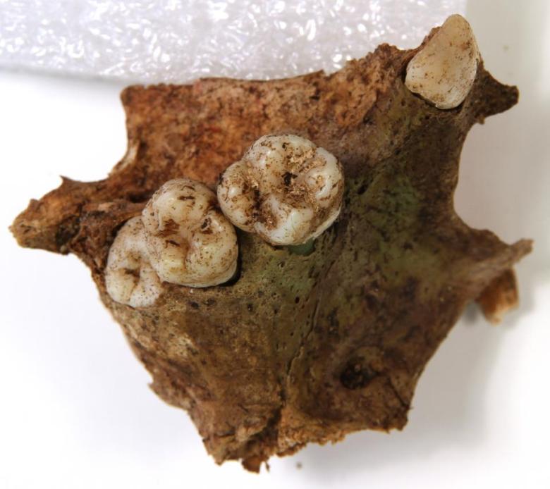 Senaatintorin luututkimusten tuloksia