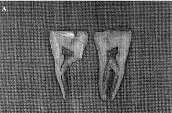 Kalmistopiiri_Bartonella