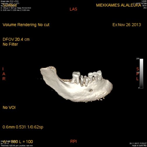 Arkeologisten kenttätöiden esittelypäivät
