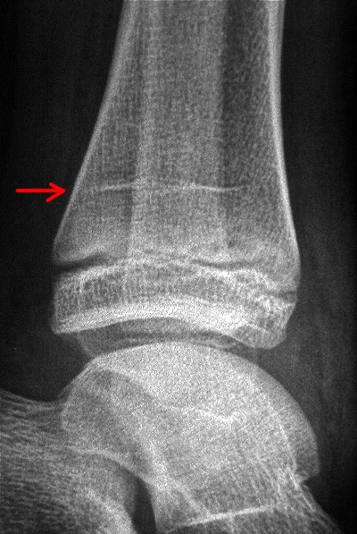 Luupiirin kokoontuminen 21.3.2014