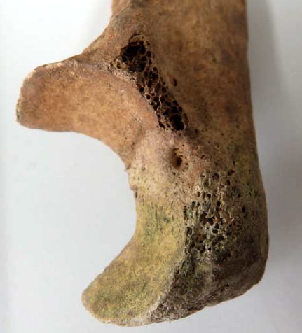 Värjäytyneet_luut3