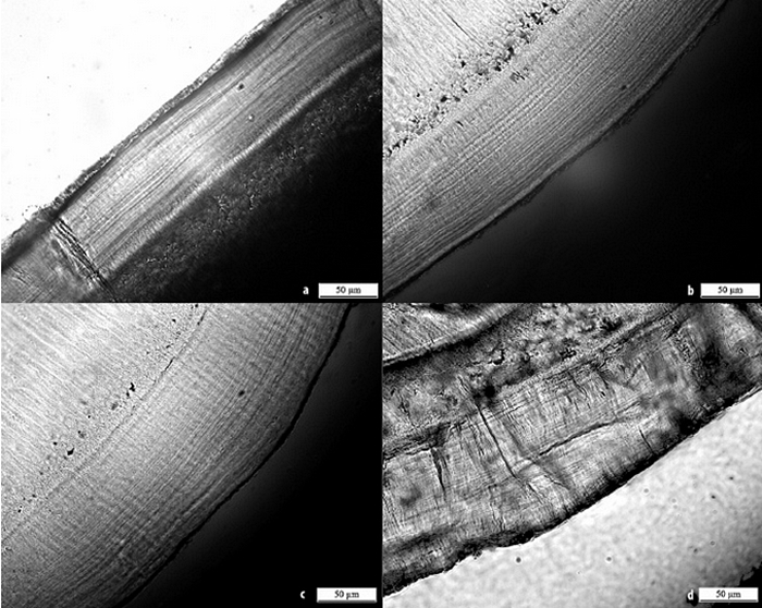 Hampaan juuren ulkopinnalla olevaan hammassementtiin muodostuu elämän aikana mikroskooppisen pieniä "vuosirenkaita".