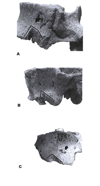 Leikkausjälkiä selkänikamissa. Löydöt Becánista (a), Calakmulista (b) ja Palenquen temppelistä (c). (Tiesler & Cucina 2006: fig. 11).