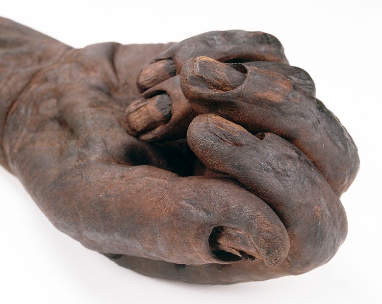 Oldcroghan-miehen käsi lähikuvassa. Kuva: National Museum Ireland.