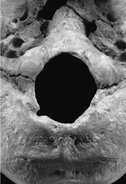 Bad Dürrenbergin vainajan kallon Kuva: Porr & Alt 2006, fig. 1.