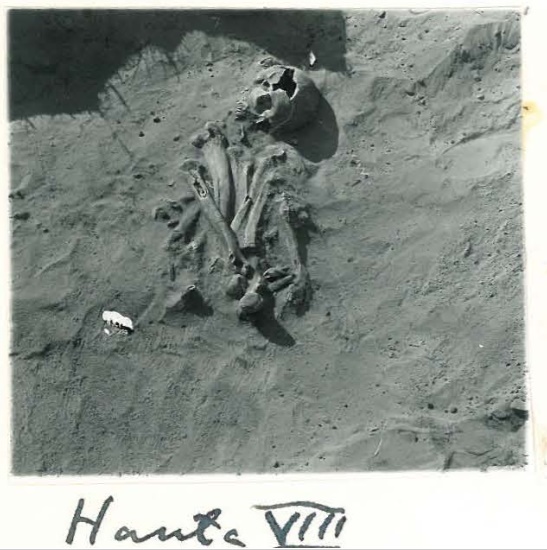 Luut, jotka eivät ole anatomisesti oikeilla paikoillaan, kertovat joka tapauksessa luiden sekundaarisesta käsittelystä - oli taustalla mikä syy tahansa. Kuvan luut Mikkelin Visulahden varhaiskeskiaikaisesta kalmistosta. (Leppäaho 1955).