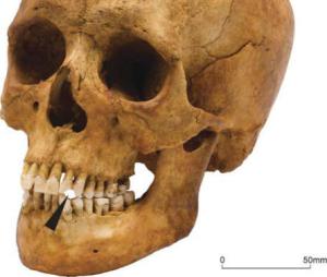 Whitechapel individual 1099